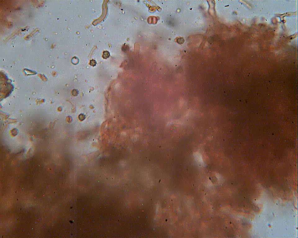 Corticiacea ospitale